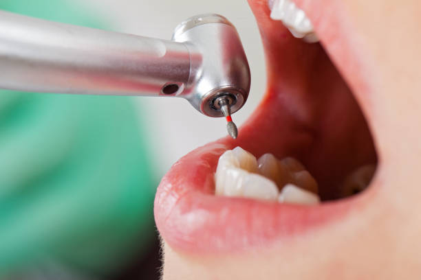 Best Emergency Treatment for Dental Infections or Abscesses in Franklinville, NC